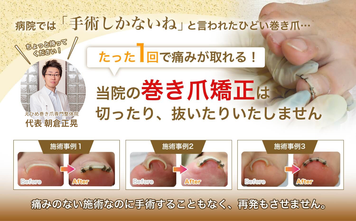 病院では「手術しかないね」と言われたひどい巻き爪…ちょっと待ってください！たった１回で痛みが取れる！当院の巻き爪矯正は切ったり、抜いたりいたしません。痛みのない施術なのに手術することもなく、再発もさせません。えひめ巻き爪専門整体院 代表 朝倉正晃