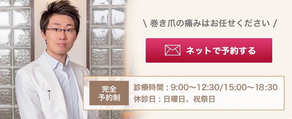 巻き爪の痛みはお任せください ネットで予約する 完全予約制 診療時間 9:00～12:30/15:00～19:30 休診日:日曜日、祝祭日