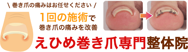 巻き爪の痛みはお任せください　1回の施術で巻き爪の痛みを改善　えひめ巻き爪専門整体院