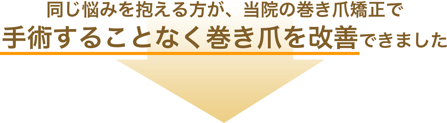 同じ悩みを抱える方が、当院の巻き爪矯正で手術することなく巻き爪を改善できました